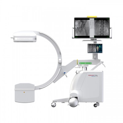 新品大尺寸移动式C形臂有何不同之处？
