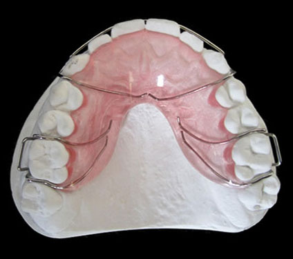 德国ClearCaps用3D打印批量生产牙套